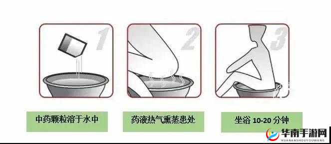 翁止熄痒最简单处理方法：盐水坐浴