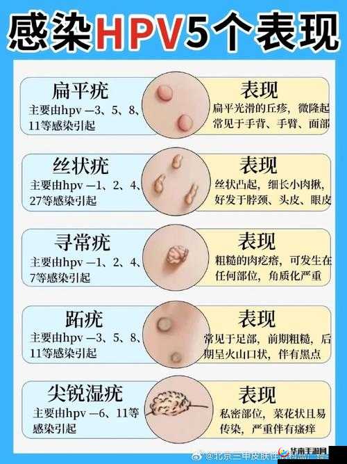 hpv 是怎么感染上的：你必须知道的事