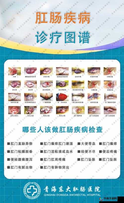 肛门息肉是什么？