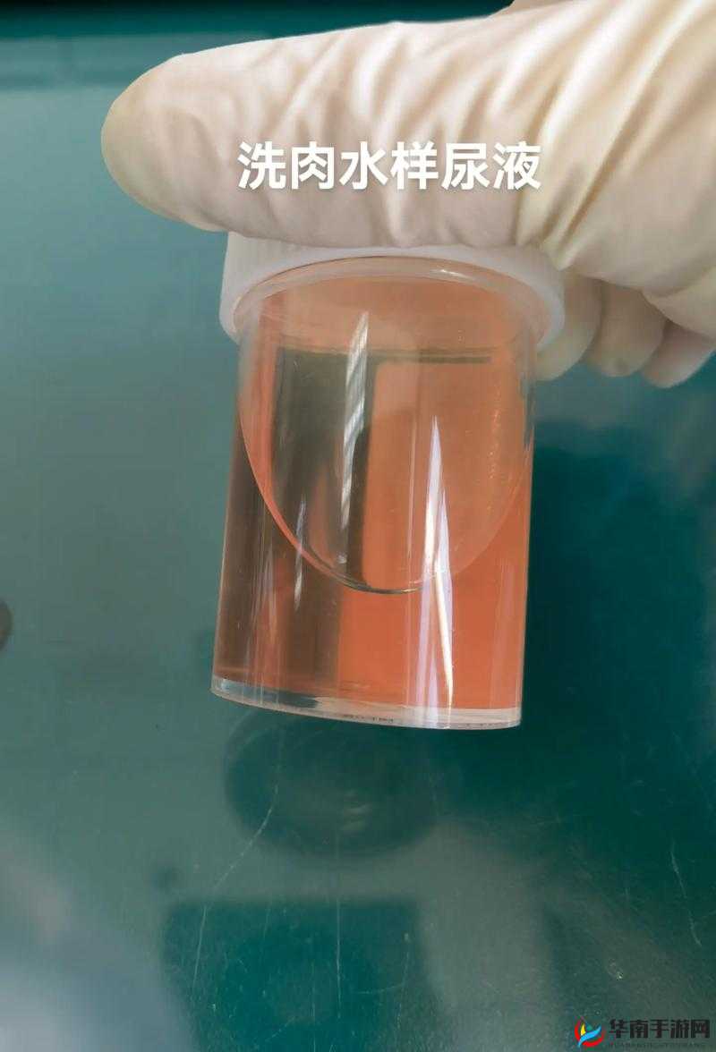 尿在肚子里不能流出来肉：一段令人费解的奇异状况描述